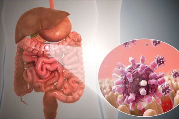 wellhealthorganic.com : key signs of gastroenteritis